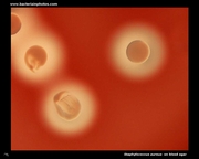 staphylococcus beta hemolysis